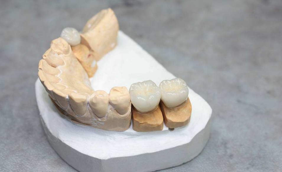 牙石危害同牙石預防