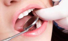 珠海牙科醫院專家介紹洗牙小常識
