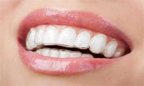 為什麼牙周病要系統治療？