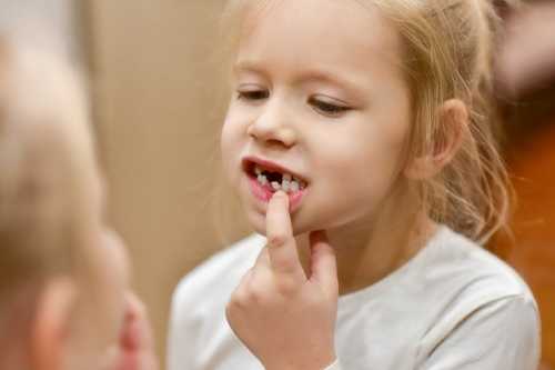 年輕恒牙最常見的牙創傷是什麼？