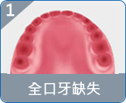 澳門全口重建推薦