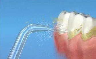 乙肝可以洗牙嗎？洗牙會感染傳染病嗎？
