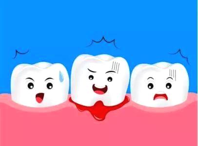 常見牙齦炎嘅特點有邊啲？