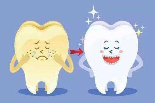 牙齒家庭美白和診室美白有乜區別？
