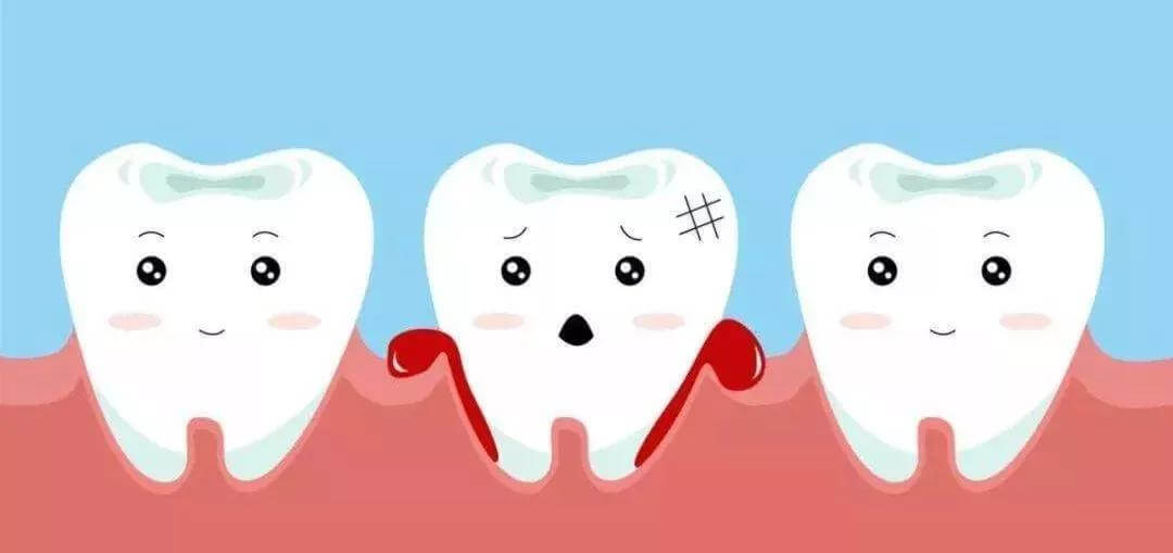 牙齦炎系一種多發性嘅疾病，如今呢個病嘅患者逐漸增多，所以大家要引起重視，對於健康嘅人嚟講，預防牙齦炎疾病就系非常關鍵嘅，預防牙齦炎疾病出現嘅方法系非常多嘅，今日我哋就嚟睇下如何預防牙齦炎。  一、使用軟毛牙擦：用軟毛牙擦擦牙齦及舌頭，對牙齦很有好處，也可以很好嘅預防牙齦炎嘅出現。擦牙齦邊緣，擦牙時唔好忽略容易堆積牙垢嘅牙齦邊緣，將牙擦傾斜45度角，由內向外刷，清除食物殘渣儘量唔碰傷牙齦，咁可預防牙齦炎。輪流使用兩只牙擦，輪流使用兩支牙擦嘅好處在於可以使另一只有時間完全風乾，從而減少細菌滋生嘅幾率，呢對牙齒嘅健康非常重要。  二、注意口腔清潔：習慣早晚擦牙及使用牙線清潔牙縫，尤其系喺瞓前，可以清除牙菌膜，減少喺瞓覺時牙菌膜嘅積聚，也可以很好嘅預防牙齦炎。每6個月至1年，定期往牙科醫生處清潔牙齒，預防牙菌膜變成牙石，及清除喺牙齒上已形成嘅牙石。  三、經常使用漱口水：漱口水可以幫助你清除牙垢，對牙齒健康很有幫助，建議每次食嘢後一定要漱口。  四、畀牙齒補鈣：牙骨疏鬆容易導致牙齦炎，可以多食含有鈣質嘅食物，嚟強化骨骼。  五、多食生蔬菜：生蔬菜含有很多纖維素，能幫助清潔及刺激牙齒及牙齦以避免牙齦炎。  六、危險訊號：牙齦痛、牙齦流血、長時間口臭、牙齒鬆動、都系牙齦炎嘅徵兆。若置之唔理將有可能導致更嚴重嘅牙周病，所以必須儘快睇牙醫。  七、戒煙、戒酒：煙和酒會流失保持口腔健康所需嘅維生素及礦物質，要想有健康嘅牙齒，必須戒煙和酒，戒煙、戒酒也可以很好嘅預防牙齦炎。  以上就系「如何預防牙齦炎」嘅具體介紹，希望對大家有所幫助。