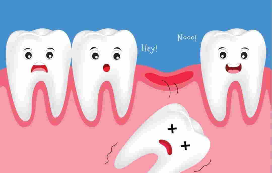 如何防止牙齒鬆動？