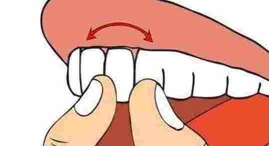 箍牙會導致牙齒鬆動嗎？