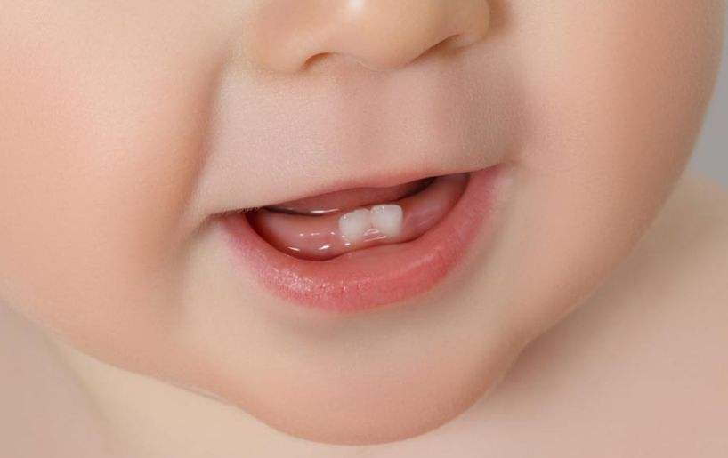點解兒童牙齒唔齊？如何預防？