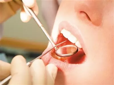 嵌體補牙和傳統補牙嘅區別有乜？