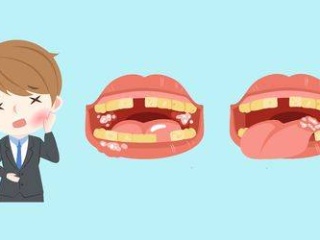 患口腔潰瘍嘅原因有乜?
