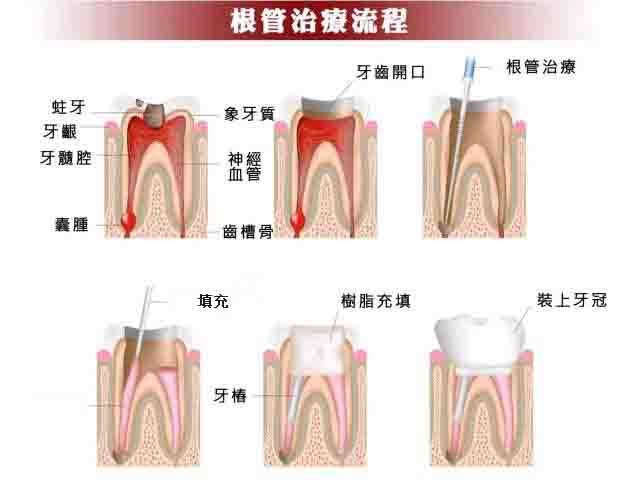 珠海杜牙根嘅過程有乜？