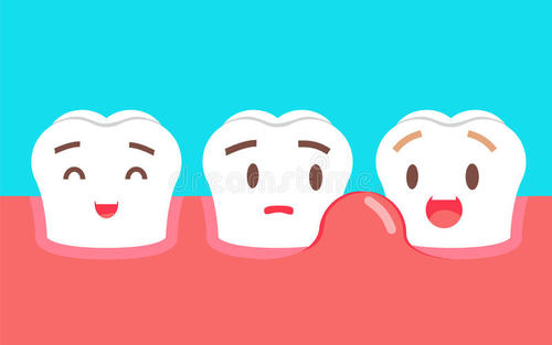 點解會得牙齦炎、牙周炎？