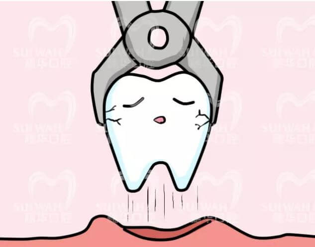 患者疑惑：拔牙過程出血多嗎？