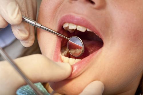補牙治療要幾錢呢？