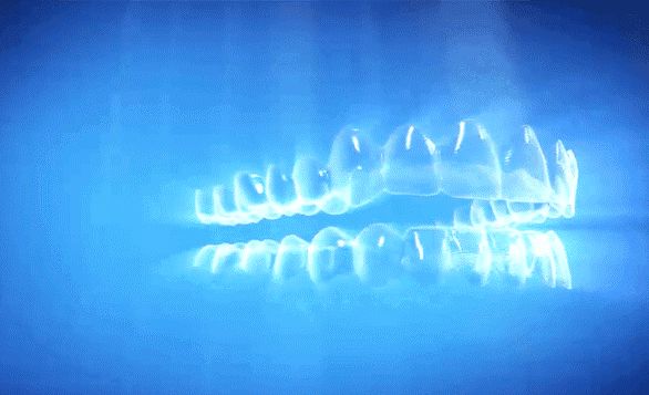 珠海隱形牙齒矯正要多少錢