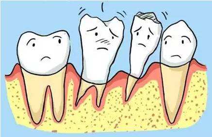 什麼是牙周病